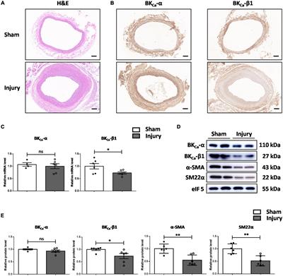 Large-conductance Ca2 +-activated K+ channel β1-subunit maintains the contractile phenotype of vascular smooth muscle cells